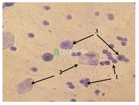 Реактивные изменения лейкоцитов. Трихомонада микроскопия. Трихомонады микроскопия нативный препарат. Клетки трихомонады под микроскопом. Трихомонады окраска метиленовым синим.